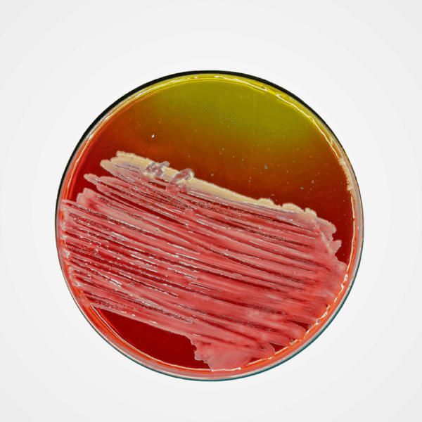 Medios de Cultivo Sólidos (Agar)
